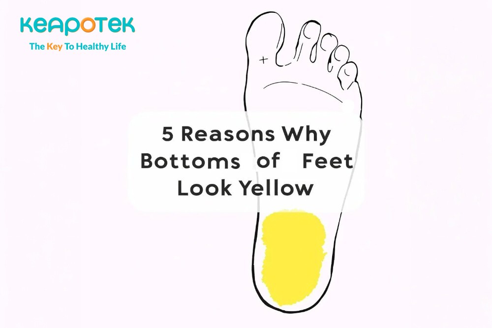 keapotek-foot-Kaki Kuning? Kenali 5 Penyebabnya
